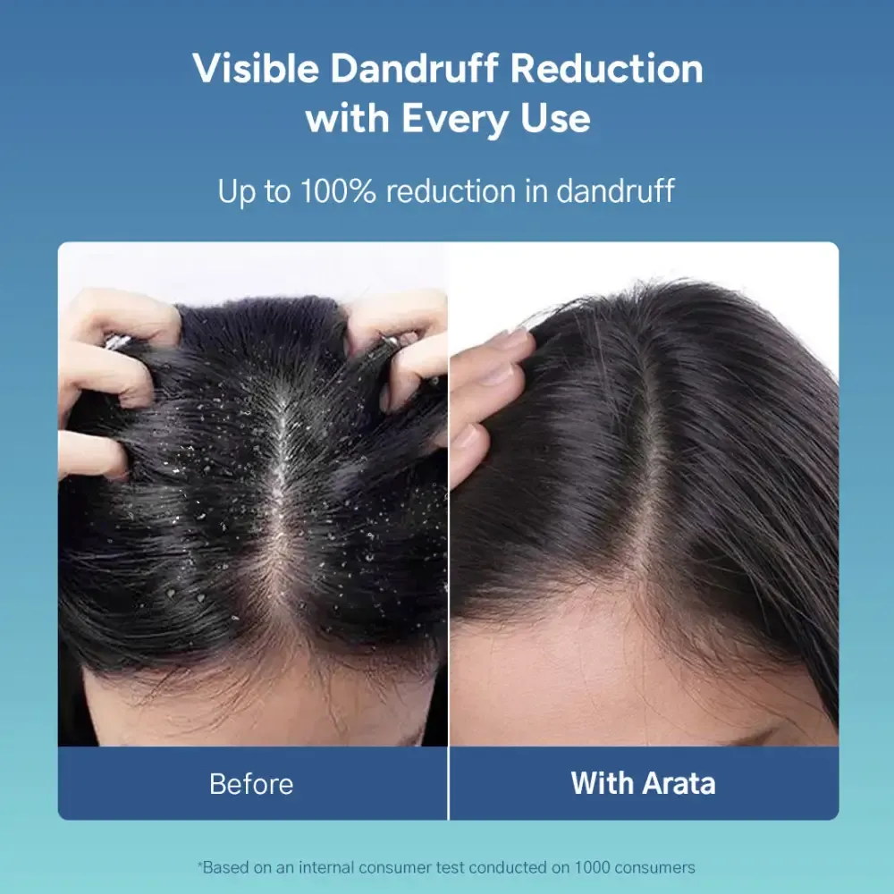 Anti-Dandruff Shampoo (Normal to Oily Hair) BYOB - Image 3